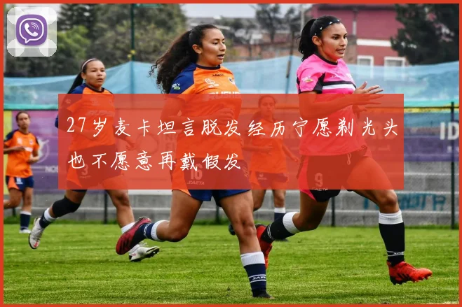 27岁麦卡坦言脱发经历宁愿剃光头也不愿意再戴假发